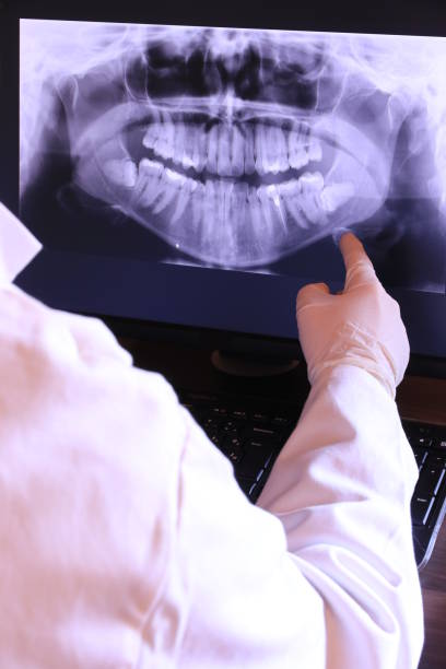 Best Broken or Chipped Tooth Repair in Laurie, MO
